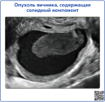 ultrasound-1, превью