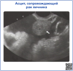 ultrasound-2, превью