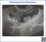 ultrasound-3, превью