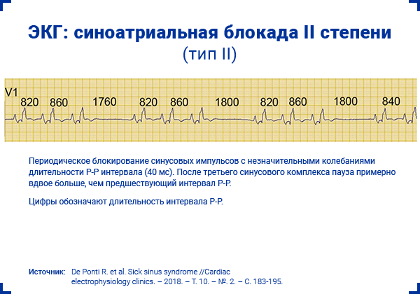 Слабость сосудистой стенки мкб 10