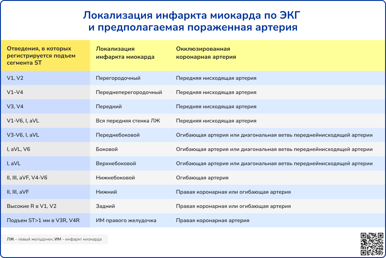 I21 Острый инфаркт миокарда: описание болезни в справочнике МКБ-10 РЛС.